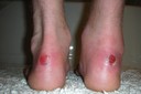 Formez vos chaussures avant le départ!